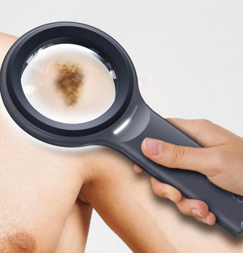 Dermatoscope 4 in 1 ILLUCO MAGNUM IDS-3100